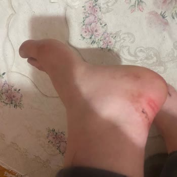 Aldığım Puma Ayakkabı Ayağımı Yaraladı, İade Talebim Reddedildi