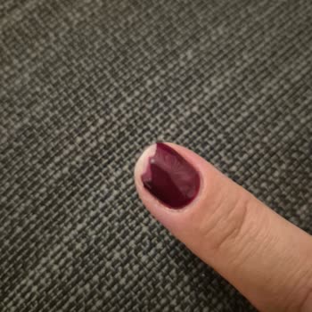 Narges Beauty Center Mekan da Kötü Yapılan İşlem de