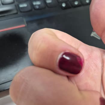 Narges Beauty Center Mekan da Kötü Yapılan İşlem de