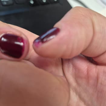 Narges Beauty Center Mekan da Kötü Yapılan İşlem de