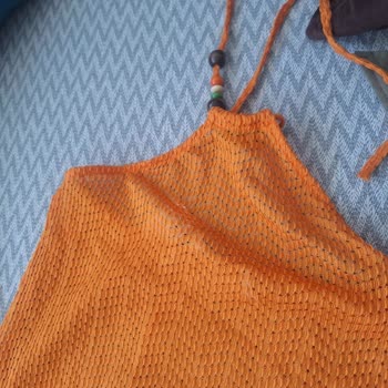 Eksik Parça Gönderimi Ve Yetersiz Bilgilendirme Mağduriyeti