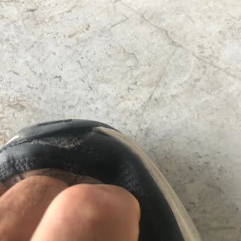 Ayakkabıda Artan Ses Ve Açılma Sonrası Mağduriyet Yaşadım
