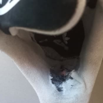 8 Ayda Yırtılan Adidas Ayakkabı Hayal Kırıklığı Yarattı