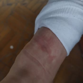 Nike Ayakkabıda Kronik Baskı Ve Uyuşma Sorunu, İnceleme Talebi