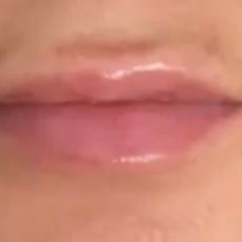 İlgisiz Ve Yetersiz Hizmet Sonucu Memnuniyetsizlik