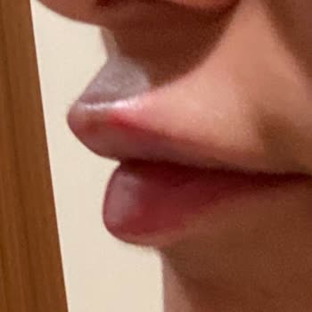 İlgisiz Ve Yetersiz Hizmet Sonucu Memnuniyetsizlik