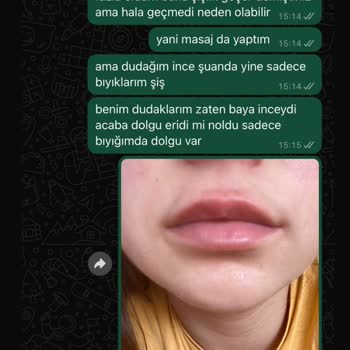 İlgisiz Ve Yetersiz Hizmet Sonucu Memnuniyetsizlik