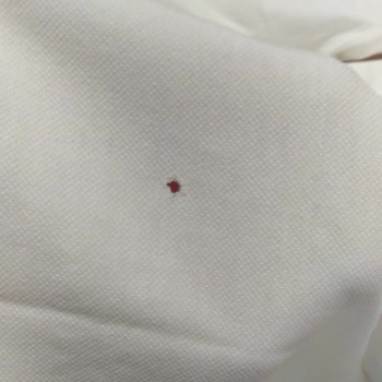 Defolu Ürün Ve Cevapsız Müşteri Hizmeti Hayal Kırıklığı