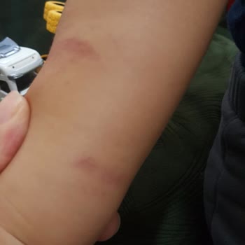 Çocuğuma Kan Alımı Sırasında Yaşanan Olumsuz Deneyim Ve İlgisiz Yaklaşım