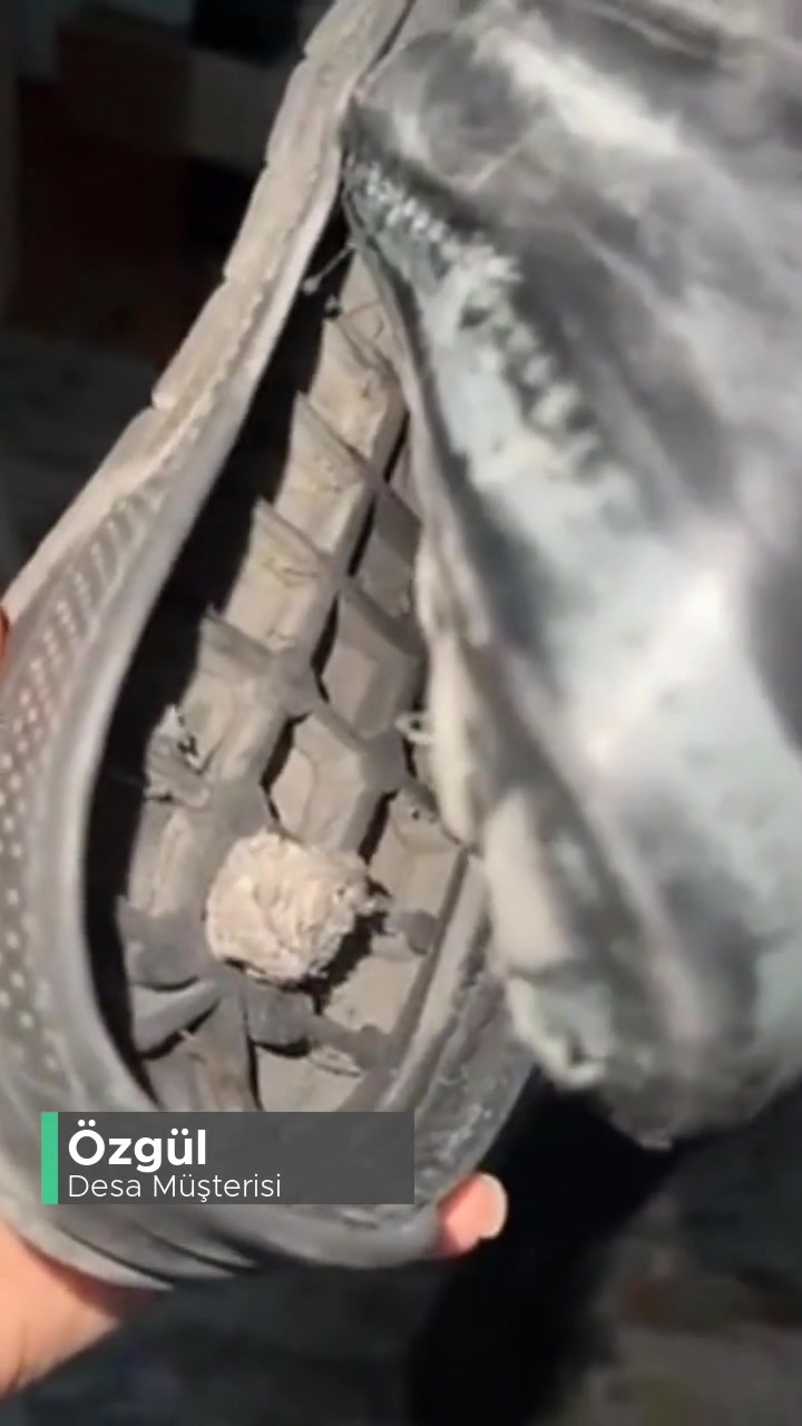 Desa Ayak Tabanı Kopması Ve Delinmesi videonun kapak resmi