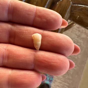 Ekinova Fırın'dan Aldığım Kraker Dişimi Kırdı