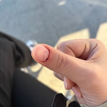 Natural Nail House Tırnak Çıkarma İşleminde Acı Ve İlgisiz Hizmet Deneyimi