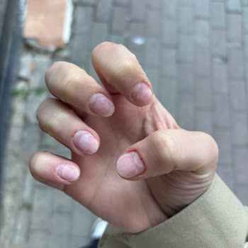 Natural Nail House Tırnak Çıkarma İşleminde Acı Ve İlgisiz Hizmet Deneyimi