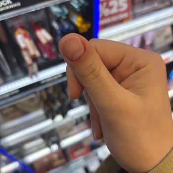 Natural Nail House Tırnak Çıkarma İşleminde Acı Ve İlgisiz Hizmet Deneyimi