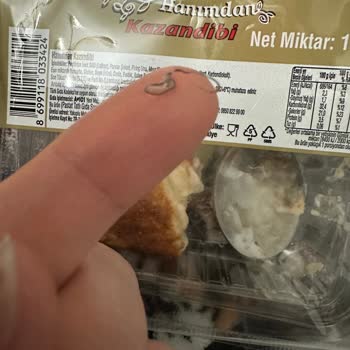 Kazandibinin İçinden Çıkan Zımba Teliyle Yaşadığım Tehlike Ve İhmal