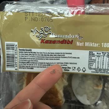 Kazandibinin İçinden Çıkan Zımba Teliyle Yaşadığım Tehlike Ve İhmal