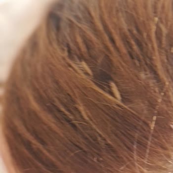 Bahar Sağun Kuaför Hatalı İşlem Yaptı