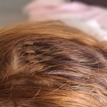 Bahar Sağun Kuaför Hatalı İşlem Yaptı