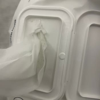 Bebek Mendilinde Küf Ve Kötü Koku Endişesi