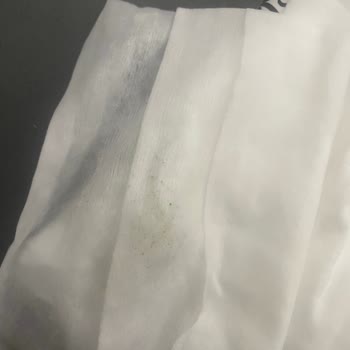 Bebek Mendilinde Küf Ve Kötü Koku Endişesi