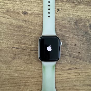 My Apple Watch 8 Strap Discolored - Unexpected Quality Issue