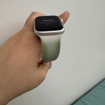 My Apple Watch 8 Strap Discolored - Unexpected Quality Issue