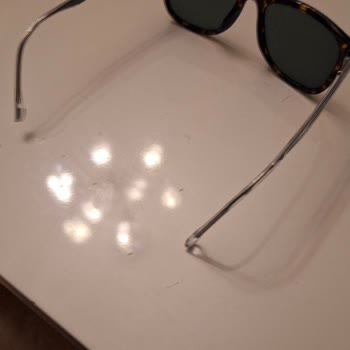 Gözlüğümün Sapı Bozuldu İlgisizlik Mağdur Etti