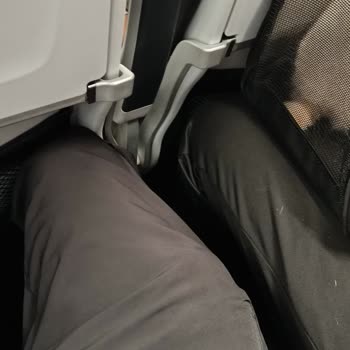 Kedi Alerjim Göz Ardı Edildi, Uçuşta Bilgilendirme Yapılmadı