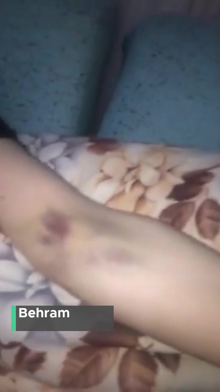 Karabük Eğitim Araştırma Hastanesi Personel Şikayeti, Kolda Yanlış Damar Yolu videonun kapak resmi