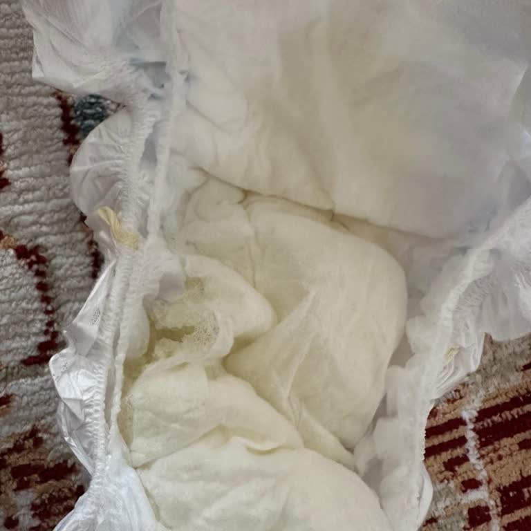 Aldığım Bebek Bezinden Sürekli Parçacıklar Çıkıyor, Sorunun Giderilmesini İstiyorum