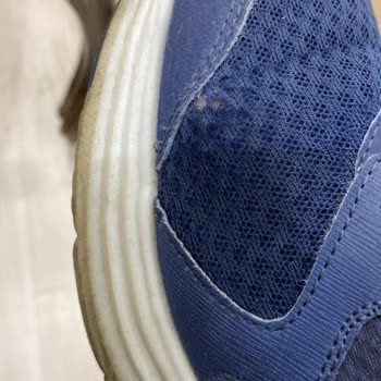 Skechers Ayakkabı Yırtılması Ve Garanti Sürecinde Destek Alamama