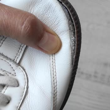 Aldığım Adidas Ayakkabı Kısa Sürede Açıldı, Üretici Firma İade Talebimi Reddetti