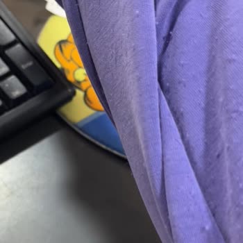 Aldığım Üründe İlk Kullanımda Tüylenme Ve İade Reddi Yaşadım