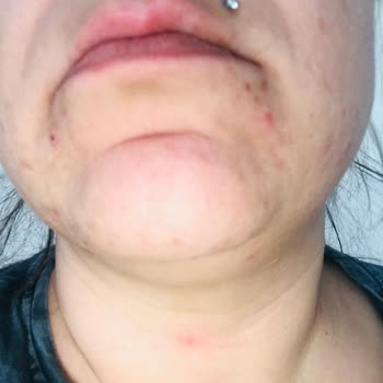 Kullandığım Üründen Beklenen Etkiyi Göremedim, Cildimde Sorunlar Arttı