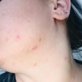 Kullandığım Üründen Beklenen Etkiyi Göremedim, Cildimde Sorunlar Arttı