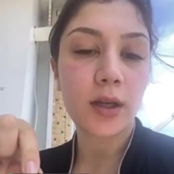 S'he Vec. Ürün Cildimi Yaktı
