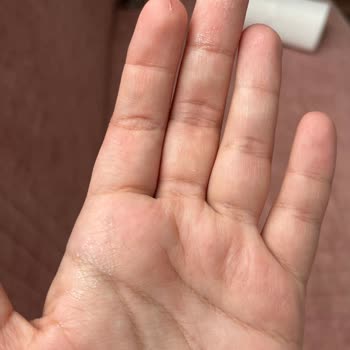 Leke Çıkarıcı Ürün Beyaz Tişörtümde Sarı Leke Ve Ağarmaya Sebep Oldu