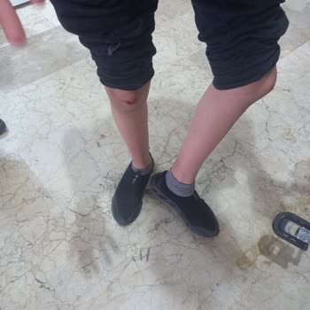 Kuba Bisikleti Sürerken Ön Tarafı Kendiliğinden Açıldı