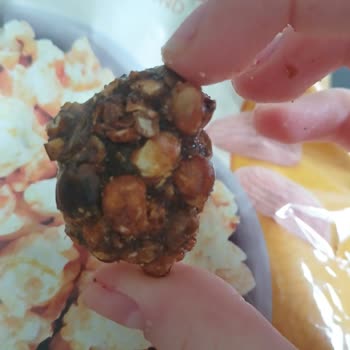 Peyman Nutzz Popcorn İçinde Sert Cisim Dişimi Kırıyordu