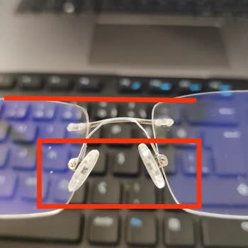 Gözlük Tamir Sürecinde Yedek Ürün Sağlanmaması Nedeniyle Mağduriyet