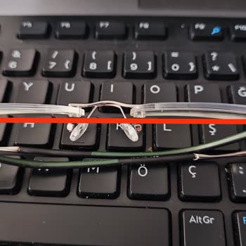 Gözlük Tamir Sürecinde Yedek Ürün Sağlanmaması Nedeniyle Mağduriyet