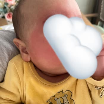 Uni Baby Islak Mendil Bebeğimin Yüzünde Ciddi Alerjiye Yol Açtı