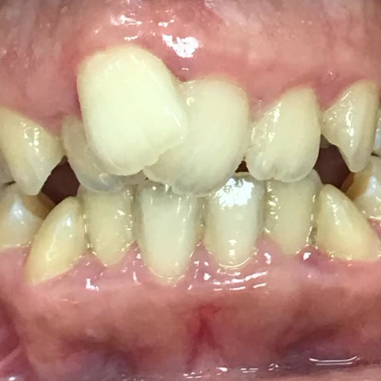 Özel Efe Ağız Ve Diş Sağlığı Polikliniği 2 Yıl Boyunca Gördüğüm Tedavim Resmen Boşa Gitti