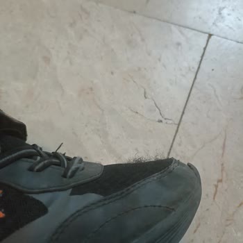 Kinetix Çocuk Ayakkabıları Hızla Deforme Oldu, Sağlık Sorunlarına Yol Açtı