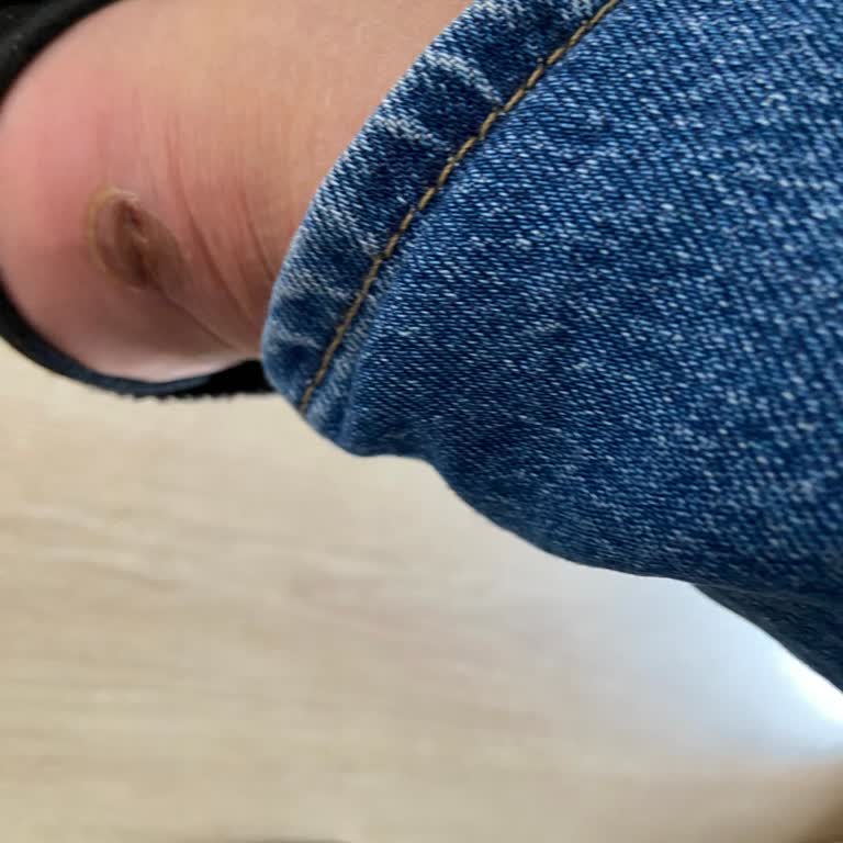 Ayakkabı İadesinde Mağduriyet Ve İlgisiz Hizmet