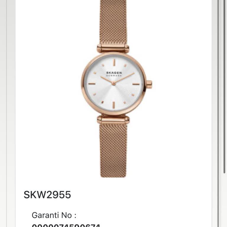 Garanti Kapsamında Olmasına Rağmen Saatimin Sorunları Kullanıcı Hatası Sayıldı