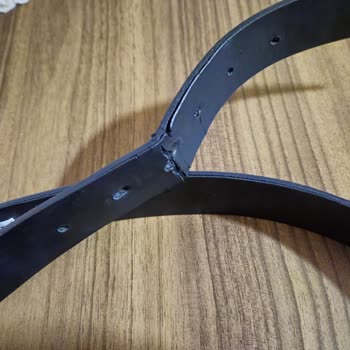 9 Ayda Deforme Olan Kemer Ve Yetersiz Değişim Süreci