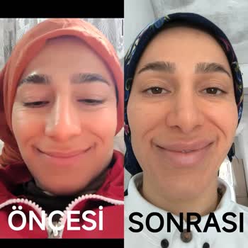 Eki aç