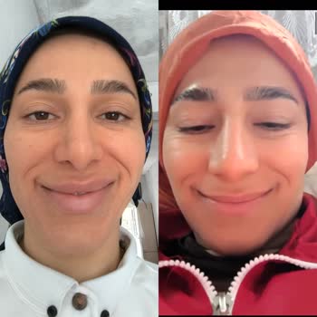 Eki aç