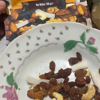 Kuruyemiş Paketinden Saç Çıktı, İnsan Sağlığı Tehlikede